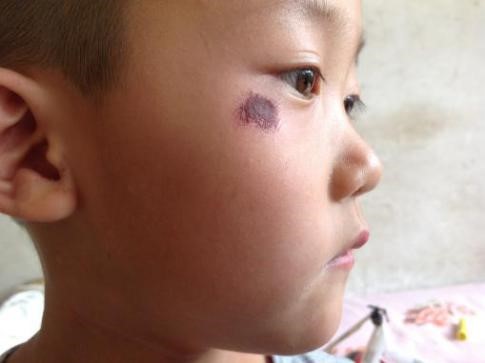 Image for article Criança de quatro anos ferida e traumatizada durante a detenção ilegal de sua mãe