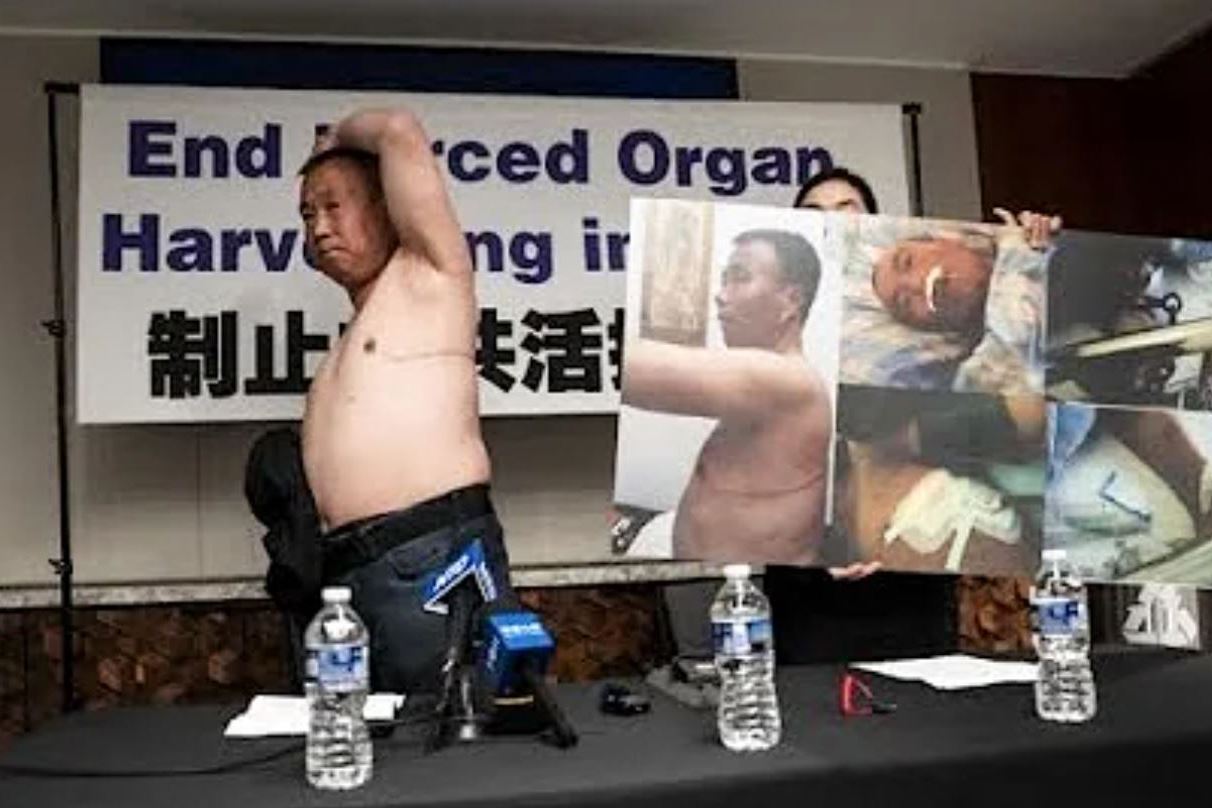 Image for article ​Meios de comunicação relatam como o PCC extraiu órgãos à força do praticante do Falun Gong Cheng Peiming (Parte 1)